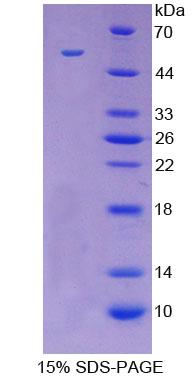 Recombinant Galectin 3 (GAL3)