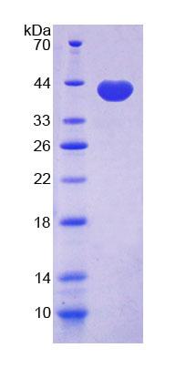 Recombinant Galectin 4 (GAL4)