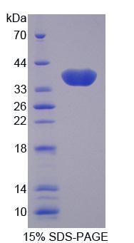 Recombinant Galectin 4 (GAL4)