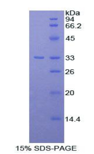 Recombinant Thyroxine Binding Globulin (TBG)