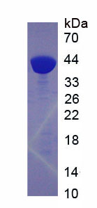 Recombinant Cathepsin L (CTSL)