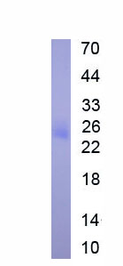 Recombinant Cathepsin L (CTSL)