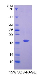 Recombinant Galectin 7 (GAL7)