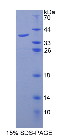 Recombinant Galectin 8 (GAL8)