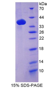 Recombinant Galectin 6 (GAL6)