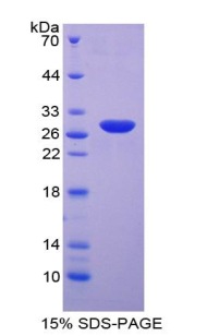 Recombinant Neutrophil Cytosolic Factor 4 (NCF4)