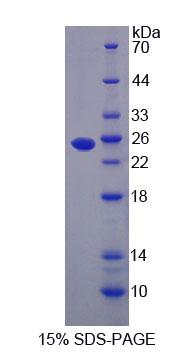 Recombinant Proteasome subunit beta type-9 (PSMB9)