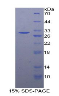 Recombinant Nitric Oxide Synthase Interacting Protein (NOSIP)