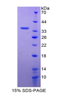 Recombinant GATA Binding Protein 2 (GATA2)