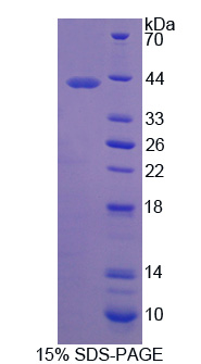 Recombinant Latrophilin 3 (LPHN3)