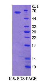 Recombinant ATP Binding Cassette Transporter D1 (ABCD1)