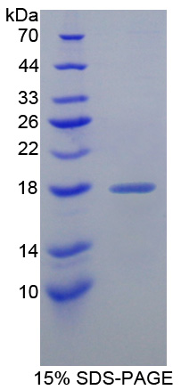 Recombinant Fatty Acid Binding Protein 6, Ileal (FABP6)