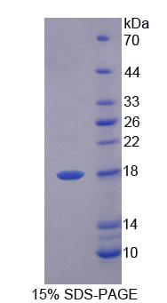 Recombinant Fatty Acid Binding Protein 6, Ileal (FABP6)