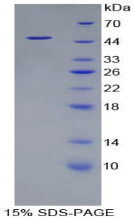 Recombinant Fatty Acid Binding Protein 6, Ileal (FABP6)