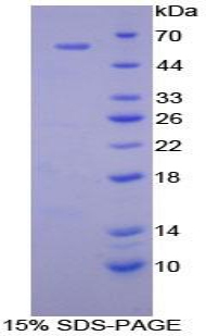 Recombinant Cathepsin A (CTSA)