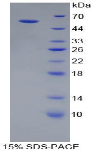 Recombinant Cathepsin A (CTSA)