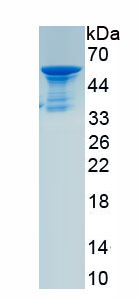 Recombinant Collagen Type I Alpha 1 (COL1a1)