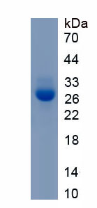 Recombinant Collagen Type I Alpha 1 (COL1a1)