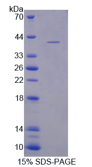 Recombinant Cocaine And Amphetamine Regulated Transcript (CART)