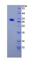 Recombinant Thyroglobulin (TG)