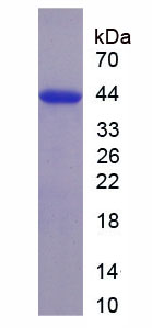 Recombinant Thyroglobulin (TG)