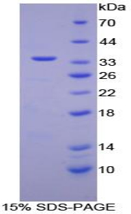 Recombinant Retinol Binding Protein 3, Interstitial (RBP3)