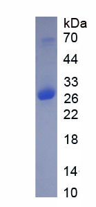 Recombinant Retinol Binding Protein 3, Interstitial (RBP3)