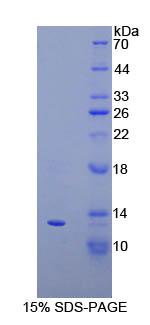 Recombinant Interferon Gamma Induced Protein 10kDa (IP10)