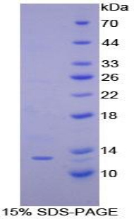 Recombinant Interferon Gamma Induced Protein 10kDa (IP10)