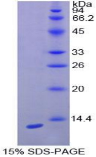 Recombinant Interferon Gamma Induced Protein 10kDa (IP10)