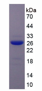 Recombinant Gelsolin (GSN)