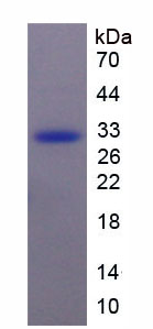 Recombinant Gelsolin (GSN)