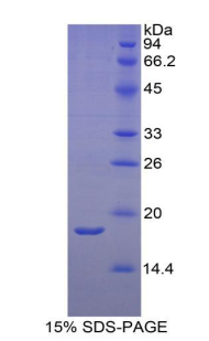 Recombinant Retinol Binding Protein 2, Cellular (RBP2)