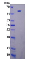 Recombinant Lipoprotein lipase (LPL)