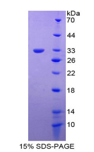 Recombinant Follistatin (FS)