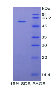 Recombinant Tissue Factor Pathway Inhibitor (TFPI)