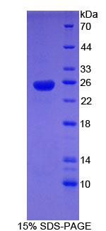 Recombinant Sex Hormone Binding Globulin (SHBG)