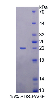 Recombinant Sex Hormone Binding Globulin (SHBG)