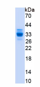 Recombinant High Mobility Group Protein 1 (HMGB1)