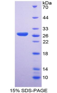 Recombinant Sex Determining Region Y Box Protein 2 (SOX2)