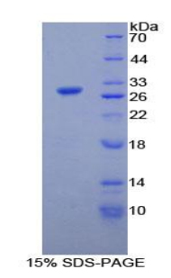 Recombinant Phospholipase A2, Calcium Independent (iPLA2)