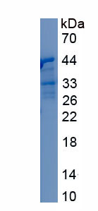 Recombinant Mucin 1 (MUC1)