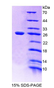 Recombinant Elastin Microfibril Interface Located Protein 1 (EMILIN1)