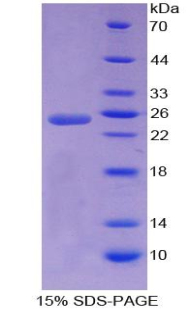 Recombinant Apobec 1 Complementation Factor (ACF)