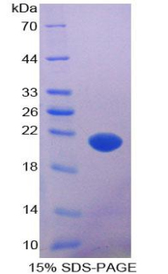 Recombinant Apoptosis Associated Tyrosine Kinase (AATK)