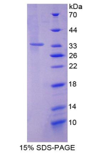 Recombinant Sirtuin 2 (SIRT2)