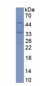 Recombinant Protein Kinase C Delta (PKCd)