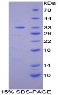 Recombinant Protein Kinase C Epsilon (PKCe)