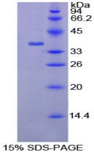 Recombinant Apoptosis Antagonizing Transcription Factor (AATF)