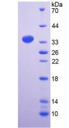 Recombinant Plakophilin 2 (PKP2)